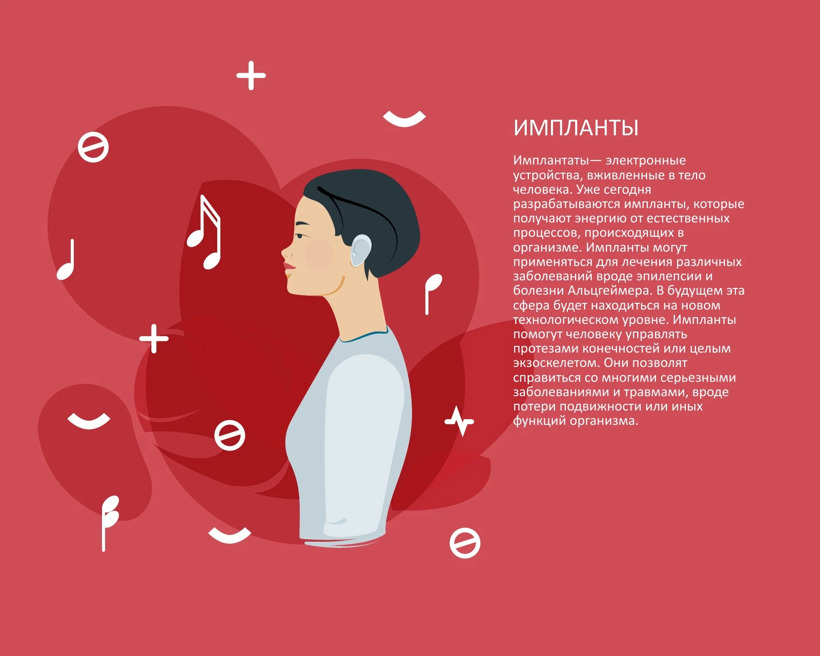 Прогноз о медицинских имплантах